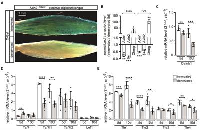 The impact of canonical Wnt transcriptional repressors TLE3 and TLE4 on postsynaptic transcription at the neuromuscular junction